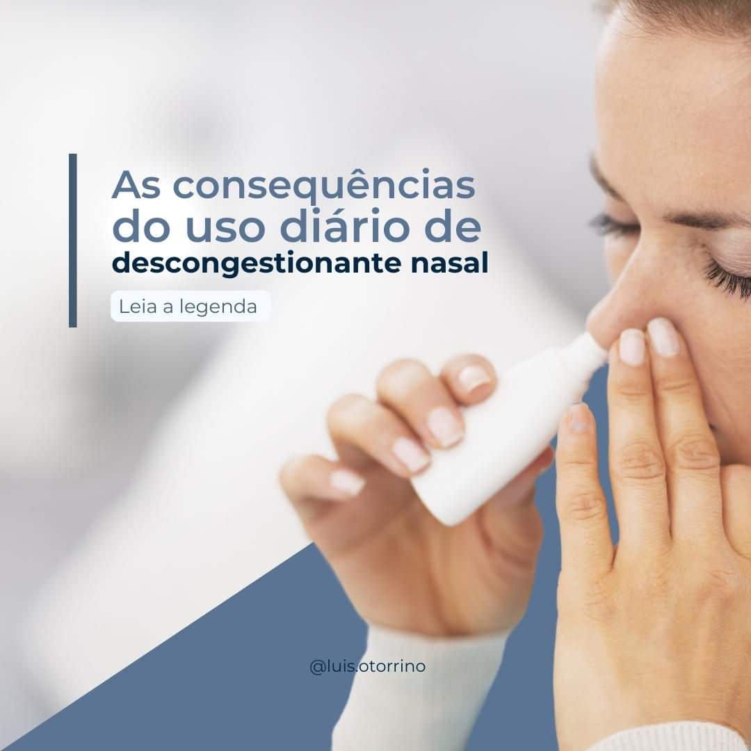 Descongestionante nasal